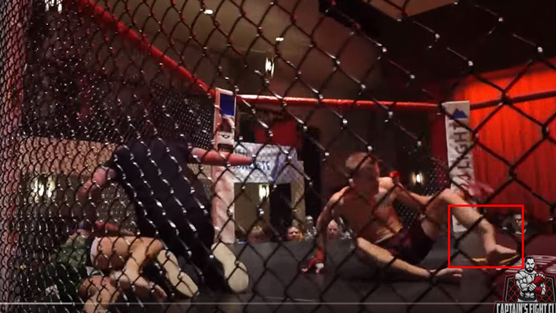 Bản sao chân gãy của Conor McGregor xuất hiện trong một trận đấu nghiệp dư - Ảnh 1