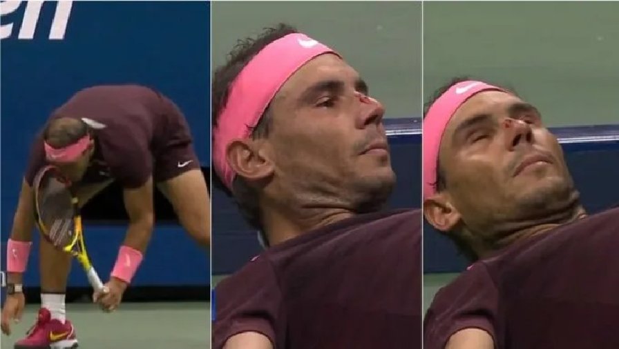 tai choang game Nadal đổ máu giữa trận gặp Fognini ở US Open 2022